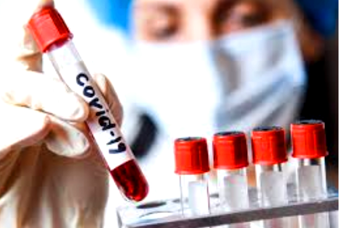 Тесты на коронавирус сдали почти 87 тысяч костромичей