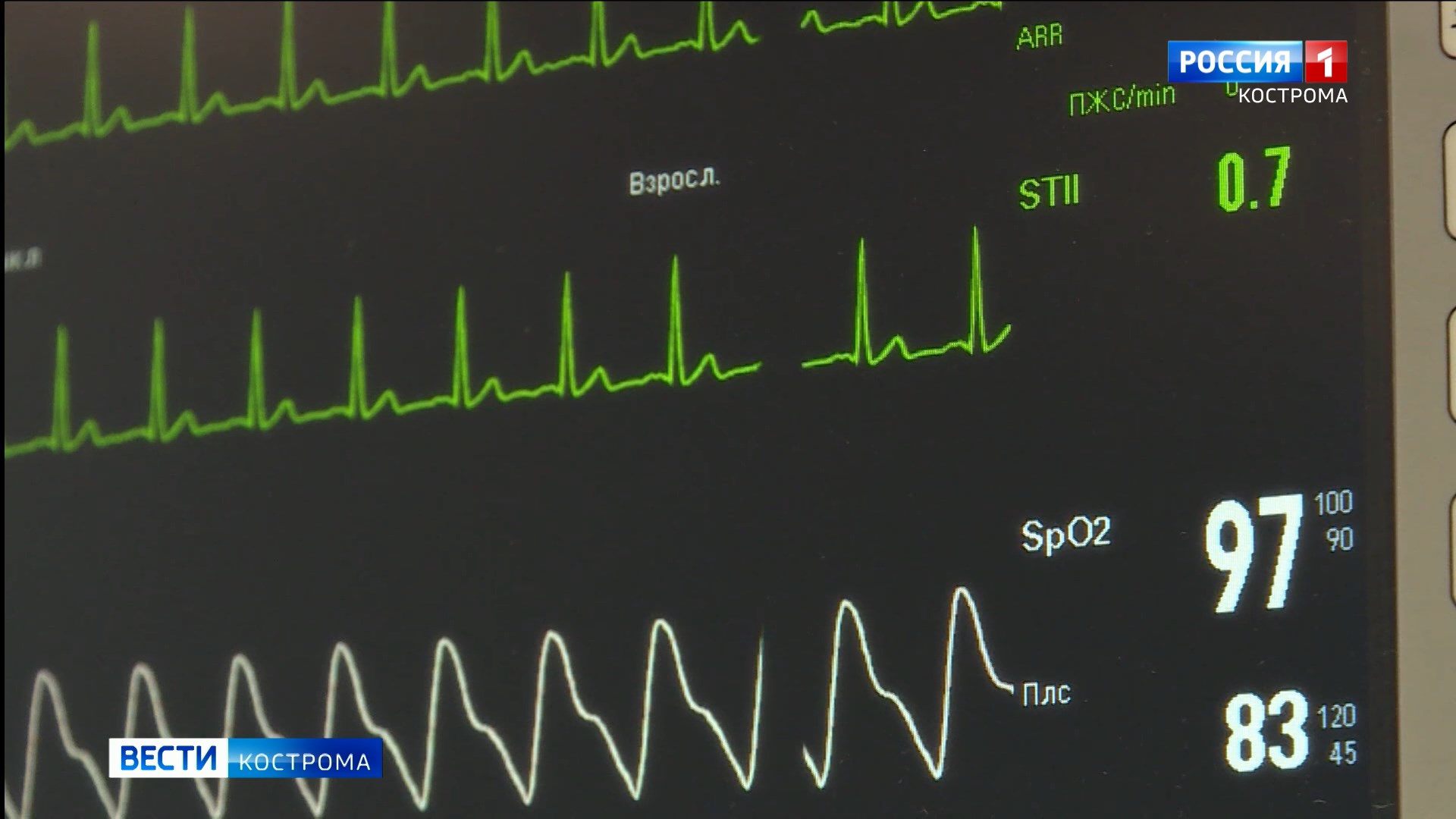 Врачи в Костроме получили допуск к операциям на открытом сердце | ГТРК « Кострома»