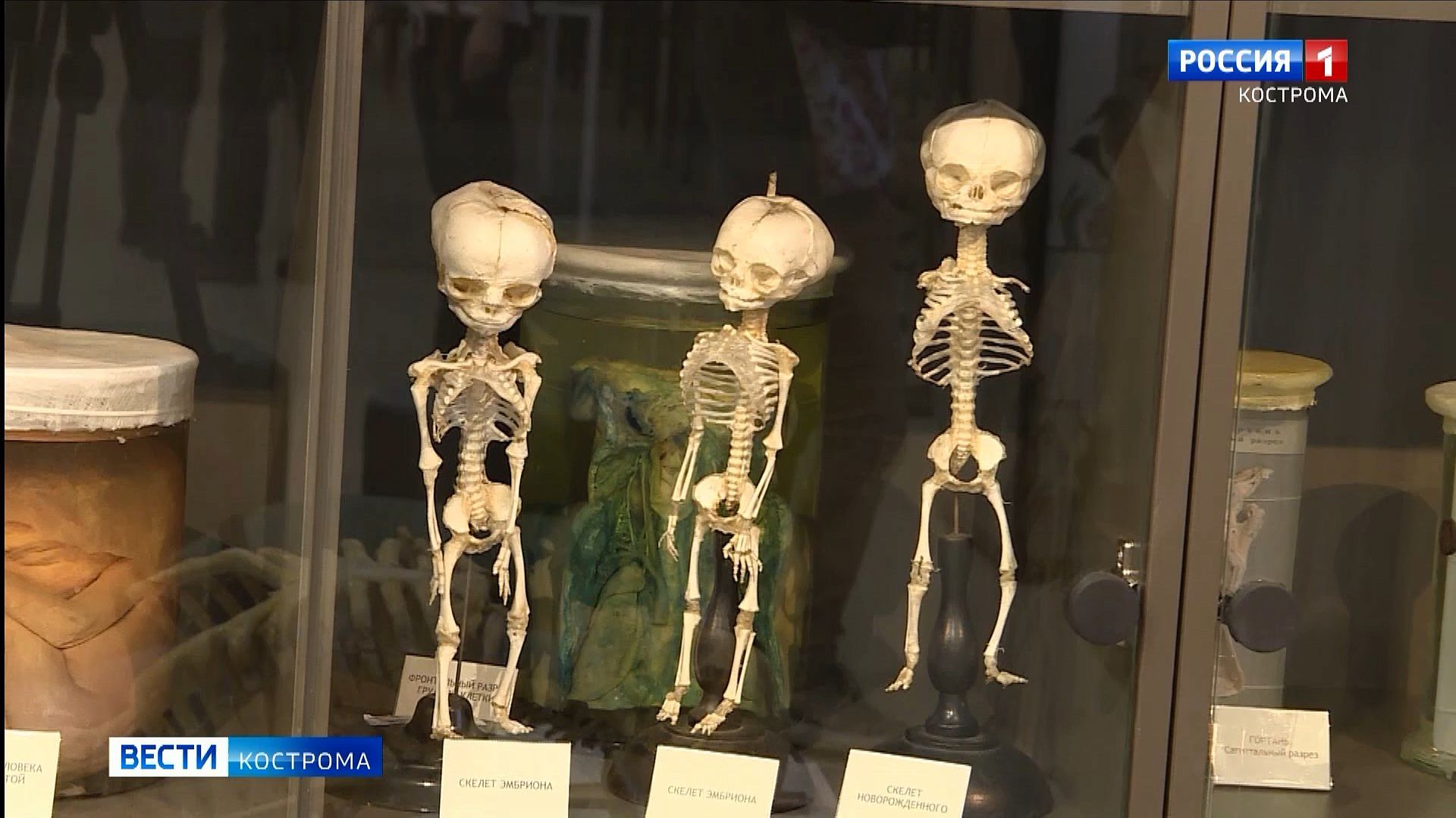 В Костроме открывается своя «кунсткамера» со скелетами